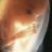 Embryo